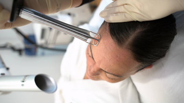 UltraClear difumina imperfecciones y estimula el colágeno de forma segura y eficaz en todo tipo de pieles, incluso en verano. Foto: Carmen Sarmiento.